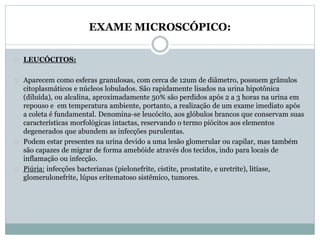 EXAME MICROSCÓPICO: 
LEUCÓCITOS: 
Aparecem como esferas granulosas, com cerca de 12um de diâmetro, possuem grânulos 
citoplasmáticos e núcleos lobulados. São rapidamente lisados na urina hipotônica 
(diluída), ou alcalina, aproximadamente 50% são perdidos após 2 a 3 horas na urina em 
repouso e em temperatura ambiente, portanto, a realização de um exame imediato após 
a coleta é fundamental. Denomina-se leucócito, aos glóbulos brancos que conservam suas 
características morfológicas intactas, reservando o termo piócitos aos elementos 
degenerados que abundem as infecções purulentas. 
Podem estar presentes na urina devido a uma lesão glomerular ou capilar, mas também 
são capazes de migrar de forma amebóide através dos tecidos, indo para locais de 
inflamação ou infecção. 
Piúria: infecções bacterianas (pielonefrite, cistite, prostatite, e uretrite), litíase, 
glomerulonefrite, lúpus eritematoso sistêmico, tumores. 
 