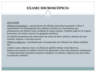 EXAME MICROSCÓPICO: 
INCLUSÕES 
Cilindros Granulosos: o aparecimento de cilindros granulosos grosseiros e finos é 
representativo da desintegração dos cilindros celulares ou leucocitários que 
permanecem nos túbulos como resultado de estase urinária. Também pode ser de origem 
bacteriana, de cristais (uratos) ou agregados protéicos. 
Os cilindros granulosos são observados em estase do fluxo urinário, infecção do trato 
urinário, estresse, e exercício severo. 
Cilindros Adiposos : é produzido pela decomposição dos cilindros de células epiteliais 
que 
contém corpos adiposos ovais. As células do epitélio tubular renal absorvem 
lipídeos que entram nos túbulos através dos glomérulos. Estes são altamente refringentes 
e contém gotículas de gordura amarelo-castanhas. Os cilindros adiposos são observados 
na síndrome nefrótica. 
 