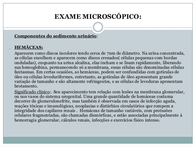 Exame microscopico do sedimento leucocitos