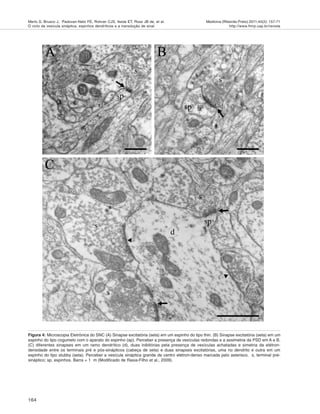 164
Medicina (Ribeirão Preto) 2011;44(2): 157-71
http://www.fmrp.usp.br/revista
Merlo S, Brusco J, Padovan-Neto FE, Rohner CJS, Ikeda ET, Ross JB de, et al.
O ciclo da vesícula sináptica, espinhos dendríticos e a transdução de sinal
Figura 4: Microscopia Eletrônica do SNC (A) Sinapse excitatória (seta) em um espinho do tipo thin. (B) Sinapse excitatória (seta) em um
espinho do tipo cogumelo com o aparato do espinho (ap). Perceber a presença de vesículas redondas e a assimetria da PSD em A e B.
(C) diferentes sinapses em um ramo dendrítico (d), duas inibitórias pela presença de vesículas achatadas e simetria da elétron-
densidade entre os terminais pré e pós-sinápticos (cabeça de seta) e duas sinapses excitatórias, uma no dendrito e outra em um
espinho do tipo stubby (seta). Perceber a vesícula sináptica grande de centro elétron-denso marcada pelo asterisco. s, terminal pré-
sináptico; sp, espinhos. Barra = 1 m (Modificado de Rasia-Filho et al., 2009).
 
