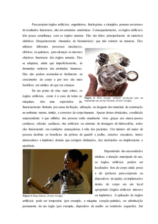 Para projetar órgãos artificiais, engenheiros, fisiologistas e cirurgiões pensam em termos
de resultados funcionais, não em estruturas anatômicas. Consequentemente, os órgãos artificiais
têm pouca semelhança com os órgãos naturais. Eles são feitos principalmente de materiais
sintéticos (frequentemente chamados de biomateriais) que não existem na natureza. Eles
utilizam diferentes processos mecânicos,
elétricos ou químicos, para alcançar os mesmos
objetivos funcionais dos órgãos naturais. Eles
se adaptam, ainda que imperfeitamente, às
demandas variáveis das atividades humanas.
Eles não podem acomodar-se facilmente ao
crescimento do corpo e por isso são mais
benéficos em adultos do que em crianças.
De um ponto de vista mais crítico, os
órgãos artificiais, como é o caso de todas as
máquinas, têm uma expectativa de
funcionamento limitada por causa da fricção, utilização ou desgaste dos materiais de construção
no ambiente morno, úmido, e corrosivo do corpo humano. Apesar destes obstáculos, a realidade
surpreendente é que milhões das pessoas estão atualmente vivas graças aos marca-passos
cardíacos, válvulas cardíacas, rins artificiais ou sistemas de drenagem de hidrocefalia, todos
eles funcionando em condições ameaçadoras à vida dos pacientes. Um número até maior de
pessoas desfruta os benefícios da prótese de quadril e joelho, enxertos vasculares, lentes
intraoculares e implantes dentais que corrigem disfunções, dor, incômodos ou simplesmente a
aparência.
Dependendo das necessidades
médicas e duração antecipada de uso,
os órgãos artificiais podem ser
localizados fora do corpo ainda preso
a ele (próteses para-corporais ou
dispositivos de ajuda), ou implantados
dentro do corpo em um local
apropriado (órgãos artificiais internos
ou implantes). A aplicação de órgãos
artificiais pode ser temporária (por exemplo, a máquina coração-pulmão), ou substituição
permanente de um órgão (por exemplo, dispositivo de auxílio ao ventrículo esquerdo). Até
Figura 2: Mini coração artificial produzido para ser
implantado em um Ser Humano. [Fonte: Google]
Figura 3: Braço biônico. [Fonte: Google]
 