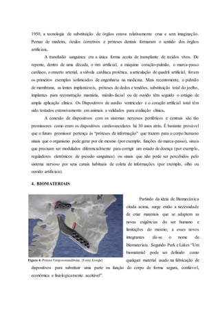 1950, a tecnologia de substituição de órgãos estava relativamente crua e sem imaginação.
Pernas de madeira, óculos corretivos e próteses dentais formaram o sentido dos órgãos
artificiais.
A transfusão sanguínea era a única forma aceita de transplante de tecidos vivos. De
repente, dentro de uma década, o rim artificial, a máquina coração-pulmão, o marca-passo
cardíaco, o enxerto arterial, a válvula cardíaca protética, a articulação de quadril artificial, foram
os primeiros exemplos sofisticados de engenharia na medicina. Mais recentemente, o pulmão
de membrana, as lentes implantáveis, próteses de dedos e tendões, substituição total do joelho,
implantes para reconstrução mamária, máxilo-facial ou de ouvido têm seguido o estágio de
ampla aplicação clínica. Os Dispositivos de auxílio ventricular e o coração artificial total têm
sido testados extensivamente em animais e validados para avaliação clínica.
A conexão de dispositivos com os sistemas nervosos periféricos e centrais são tão
promissores como eram os dispositivos cardiovasculares há 30 anos atrás. É bastante provável
que o futuro promissor pertença às “próteses de informação” que trazem para o corpo humano
sinais que o organismo pode gerar por ele mesmo (por exemplo, funções do marca-passo), sinais
que precisam ser modulados diferencialmente para corrigir um estado de doença (por exemplo,
reguladores eletrônicos de pressão sanguínea) ou sinais que não pode ser percebidos pelo
sistema nervoso por seus canais habituais de coleta de informações (por exemplo, olho ou
ouvido artificiais).
4. BIOMATERIAIS
Partindo da ideia de Biomecânica
citada acima, surge então a necessidade
de criar materiais que se adaptem as
novas exigências do ser humano e
limitações do mesmo; a esses novos
integrantes dá-se o nome de
Biomateriais. Segundo Park e Lakes “Um
biomaterial pode ser definido como
qualquer material usado na fabricação de
dispositivos para substituir uma parte ou função do corpo de forma segura, confiável,
econômica e fisiologicamente aceitável”.
Figura 4: PróteseTemporomandibular. [Fonte:Google]
 
