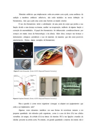 Materiais artificiais que simplesmente estão em contato com a pele, como auxiliares de
audição e membros artificiais utilizáveis, não estão incluídos na nossa definição de
biomateriais, visto que a pele atua como uma barreira ao mundo exterior.
O uso dos biomateriais inclui a substituição de uma parte do corpo que perdeu a sua
função devido a uma doença ou trauma, auxiliar na recuperação, melhoria de alguma função e
correção de anormalidades. O papel dos biomateriais foi influenciado consideravelmente por
avanços em muitas áreas da biotecnologia e da ciência. Além disso, avanços nas técnicas e
instrumentos cirúrgicos permitiram o uso de materiais de maneiras que não eram possíveis
anteriormente. Abaixo, alguns exemplos de biomateriais:
Figura 6: ImplanteDentário. [Fonte: AUST-Abuja and Princeton University]
Mas a questão é: como nosso organismo consegue se adaptar aos equipamentos que
estão a ser implantados nele?
Algumas vezes elementos metálicos em suas formas de ocorrência naturais e em
pequena quantidade são tolerados pelo organismo, como é o caso do ferro (Fe) nas células
vermelhas do sangue, do cobalto (Co) na síntese de vitamina B12 e nas ligações cruzadas da
elastina presente na artéria aorta. No entanto, em grande quantidade a maioria dos metais não é
Figura 5: Lente Intraocular. [Fonte:AUST-Abuja and Princeton University]
 
