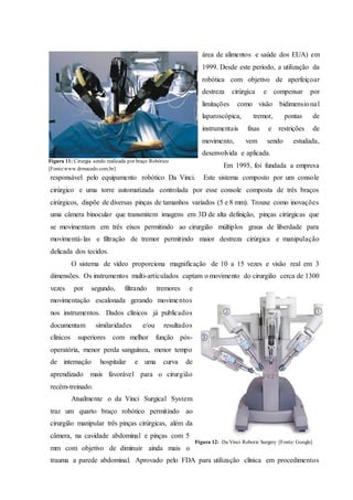 área de alimentos e saúde dos EUA) em
1999. Desde este período, a utilização da
robótica com objetivo de aperfeiçoar
destreza cirúrgica e compensar por
limitações como visão bidimensional
laparoscópica, tremor, pontas de
instrumentais fixas e restrições de
movimento, vem sendo estudada,
desenvolvida e aplicada.
Em 1995, foi fundada a empresa
responsável pelo equipamento robótico Da Vinci. Este sistema composto por um console
cirúrgico e uma torre automatizada controlada por esse console composta de três braços
cirúrgicos, dispõe de diversas pinças de tamanhos variados (5 e 8 mm). Trouxe como inovações
uma câmera binocular que transmitem imagens em 3D de alta definição, pinças cirúrgicas que
se movimentam em três eixos permitindo ao cirurgião múltiplos graus de liberdade para
movimentá-las e filtração de tremor permitindo maior destreza cirúrgica e manipulação
delicada dos tecidos.
O sistema de vídeo proporciona magnificação de 10 a 15 vezes e visão real em 3
dimensões. Os instrumentos multi-articulados captam o movimento do cirurgião cerca de 1300
vezes por segundo, filtrando tremores e
movimentação escalonada gerando movimentos
nos instrumentos. Dados clínicos já publicados
documentam similaridades e/ou resultados
clínicos superiores com melhor função pós-
operatória, menor perda sanguínea, menor tempo
de internação hospitalar e uma curva de
aprendizado mais favorável para o cirurgião
recém-treinado.
Atualmente o da Vinci Surgical System
traz um quarto braço robótico permitindo ao
cirurgião manipular três pinças cirúrgicas, além da
câmera, na cavidade abdominal e pinças com 5
mm com objetivo de diminuir ainda mais o
trauma a parede abdominal. Aprovado pelo FDA para utilização clínica em procedimentos
Figura 11: Cirurgia sendo realizada por braço Robótico
[Fonte:www.drmacedo.com.br]
Figura 12: Da Vinci Robotic Surgery [Fonte: Google]
 