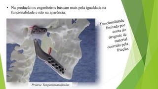 • Na produção os engenheiros buscam mais pela igualdade na
funcionalidade e não na aparência.
Prótese Temporomandibular.
 