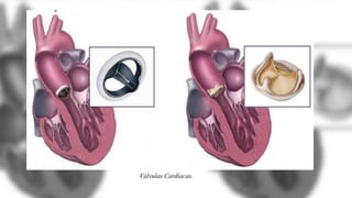 Válvulas Cardíacas.
 