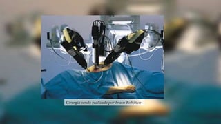 Cirurgia sendo realizada por braço Robótico
 