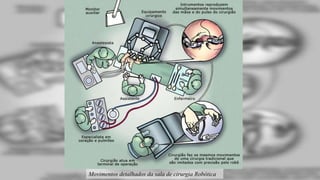 Movimentos detalhados da sala de cirurgia Robótica
 