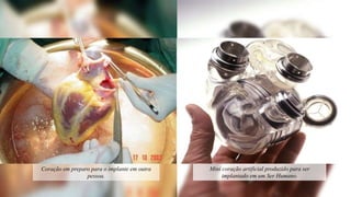 Mini coração artificial produzido para ser
implantado em um Ser Humano.
Coração em preparo para o implante em outra
pessoa.
 