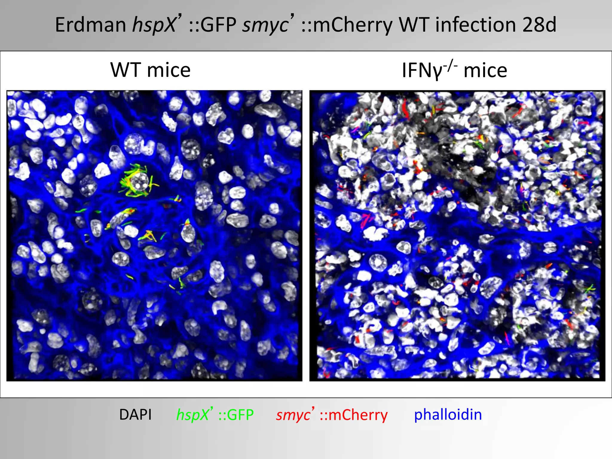 Erdman hspX’::GFP smyc’::mCherry WT infection 28d
WT mice IFNγ-/- mice
smyc’::mCherryhspX’::GFP phalloidinDAPI
 