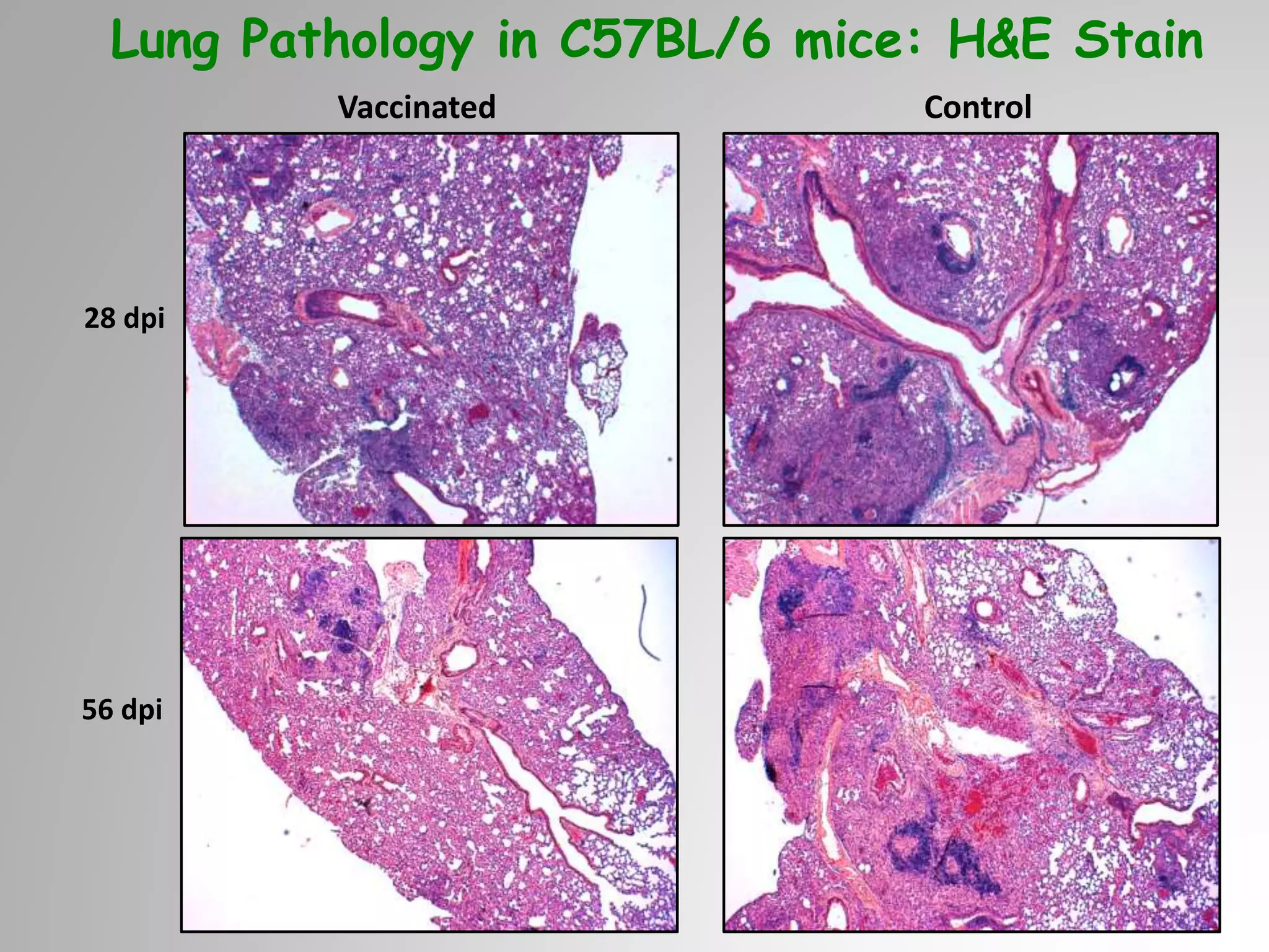 28 dpi
Vaccinated Control
56 dpi
Lung Pathology in C57BL/6 mice: H&E Stain
 