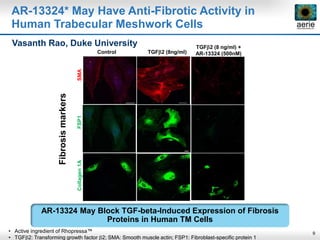 9
AR-13324* May Have Anti-Fibrotic Activity in
Human Trabecular Meshwork Cells
Fibrosismarkers
Control TGFb2 (8ng/ml)
Collagen1AFSP1SMA
TGFb2 (8 ng/ml) +
AR-13324 (500nM)
Vasanth Rao, Duke University
• Active ingredient of Rhopressa™
• TGFb2: Transforming growth factor b2; SMA: Smooth muscle actin; FSP1: Fibroblast-specific protein 1
AR-13324 May Block TGF-beta-Induced Expression of Fibrosis
Proteins in Human TM Cells
 