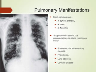 Pulmonary Manifestations
 Most common spp –
 N. cyriaci-georgica,
 N. nova,
 N. farcinica.
 Suppurative in nature, but
granulomatous or mixed responses
occur
 Endobronchial inflammatory
masses,
 Pneumonia,
 Lung abscess,
 Cavitary disease
 