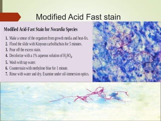 Modified Acid Fast stain
 