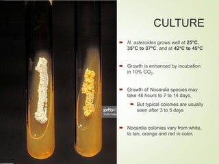 CULTURE
 N. asteroides grows well at 25°C,
35°C to 37°C, and at 42°C to 45°C
 Growth is enhanced by incubation
in 10% CO2.
 Growth of Nocardia species may
take 48 hours to 7 to 14 days,
 But typical colonies are usually
seen after 3 to 5 days
 Nocardia colonies vary from white,
to tan, orange and red in color.
 