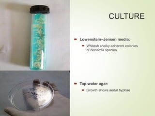 CULTURE
 Lowenstein–Jensen media:
 Whitesh chalky adherent colonies
of Nocardia species
 Tap-water agar:
 Growth shows aerIal hyphae
 