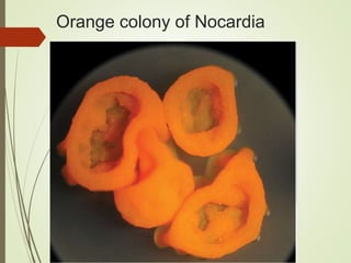 Orange colony of Nocardia
 