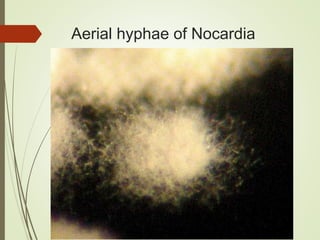 Aerial hyphae of Nocardia
 