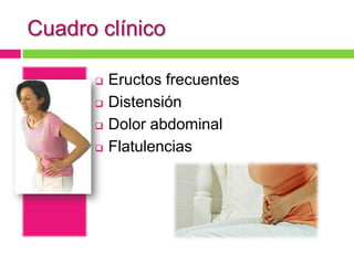 Cuadro clínico

         Eructos frecuentes
         Distensión
         Dolor abdominal
         Flatulencias
 