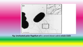 Fig: Unsheated polar flagellum of A. veronii biovar sobria strain CA25
 