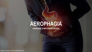 AEROPHAGIA
OVERVIEW, SYMPTOMS & CAUSES
www.bestgastroahmedabad.com
 