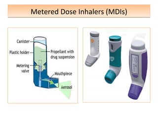 Metered Dose Inhalers (MDIs)
Metered Dose Inhalers (MDIs)
 