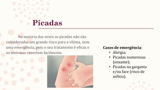 Picadas
Na maioria das vezes as picadas não são
consideradas um grande risco para a vítima, nem
uma emergência, pois o seu tratamento é eficaz e
os sintomas revertem facilmente.
Casos de emergência:
• Alergia;
• Picadas numerosas
(enxame);
• Picadas na garganta
e/ou face (risco de
asfixia).
 