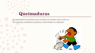 Queimaduras
As queimaduras são lesões que resultam do contato com o calor ou
frio extremo, substâncias químicas, eletricidade ou radiações.
 