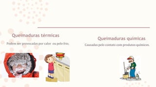 Queimaduras térmicas
Causadas pelo contato com produtos químicos.
Podem ser provocadas por calor ou pelo frio.
Queimaduras químicas
 