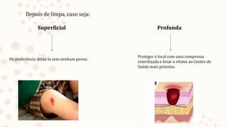 Depois de limpa, caso seja:
Superficial Profunda
De preferência deixá-la sem nenhum penso.
Proteger o local com uma compressa
esterilizada e levar a vítima ao Centro de
Saúde mais próximo.
 