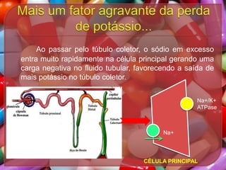 Ao passar pelo túbulo coletor, o sódio em excesso
entra muito rapidamente na célula principal gerando uma
carga negativa no fluido tubular, favorecendo a saída de
mais potássio no túbulo coletor.
Na+/K+
ATPase

Na+

CÉLULA PRINCIPAL

 
