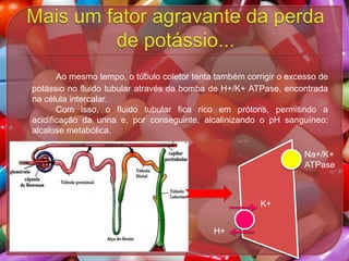 Ao mesmo tempo, o túbulo coletor tenta também corrigir o excesso de
potássio no fluido tubular através da bomba de H+/K+ ATPase, encontrada
na célula intercalar.
Com isso, o fluido tubular fica rico em prótons, permitindo a
acidificação da urina e, por conseguinte, alcalinizando o pH sanguíneo:
alcalose metabólica.
Na+/K+
ATPase

K+
H+

 