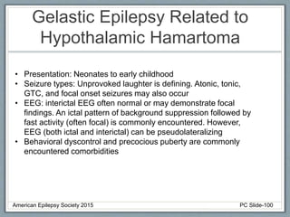 Gelastic Epilepsy Related to
Hypothalamic Hamartoma
• Presentation: Neonates to early childhood
• Seizure types: Unprovoked laughter is defining. Atonic, tonic,
GTC, and focal onset seizures may also occur
• EEG: interictal EEG often normal or may demonstrate focal
findings. An ictal pattern of background suppression followed by
fast activity (often focal) is commonly encountered. However,
EEG (both ictal and interictal) can be pseudolateralizing
• Behavioral dyscontrol and precocious puberty are commonly
encountered comorbidities
American Epilepsy Society 2015 PC Slide-100
 