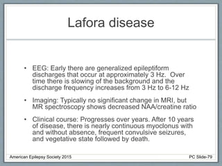 Lafora disease
• EEG: Early there are generalized epileptiform
discharges that occur at approximately 3 Hz. Over
time there is slowing of the background and the
discharge frequency increases from 3 Hz to 6-12 Hz
• Imaging: Typically no significant change in MRI, but
MR spectroscopy shows decreased NAA/creatine ratio
• Clinical course: Progresses over years. After 10 years
of disease, there is nearly continuous myoclonus with
and without absence, frequent convulsive seizures,
and vegetative state followed by death.
American Epilepsy Society 2015 PC Slide-79
 