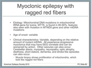 Myoclonic epilepsy with
ragged red fibers
• Etiology: Mitochondrial DNA mutations in mitochondrial
tRNA gene for lysine, MTTK, is found in 80-90%, features
also seen with mutation in MTND5 gene and other mtDNA
mutations
• Age of onset: variable
• Clinical characteristics: Variable, depending on the relative
amount of mutant mtDNA. All experience progressive
myoclonus that may have EEG correlate and can be
worsened by action. Other seizures can also occur.
Cerebellar ataxia, myopathy, neuropathy, optic atrophy,
deafness, short stature, dementia, and stroke like episodes
can also occur.
• Muscle biopsy shows proliferation of mitochondria, which
look like ragged red fibers
American Epilepsy Society 2015 PC Slide-80
 