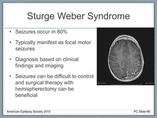 Sturge Weber Syndrome
• Seizures occur in 80%
• Typically manifest as focal motor
seizures
• Diagnosis based on clinical
findings and imaging
• Seizures can be difficult to control
and surgical therapy with
hemispherectomy can be
beneficial
American Epilepsy Society 2015 PC Slide-96
 