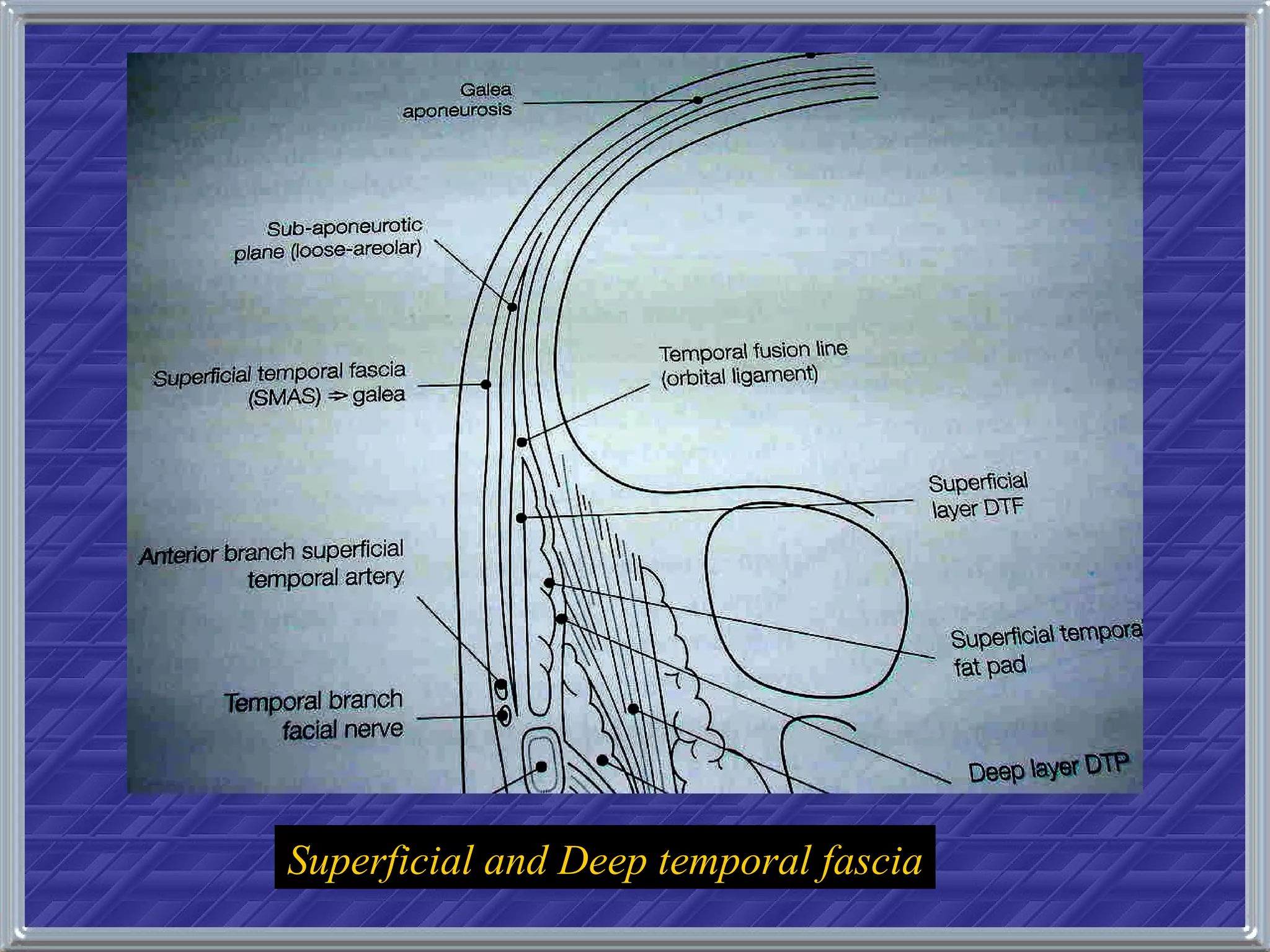 Superficial and Deep temporal fascia 