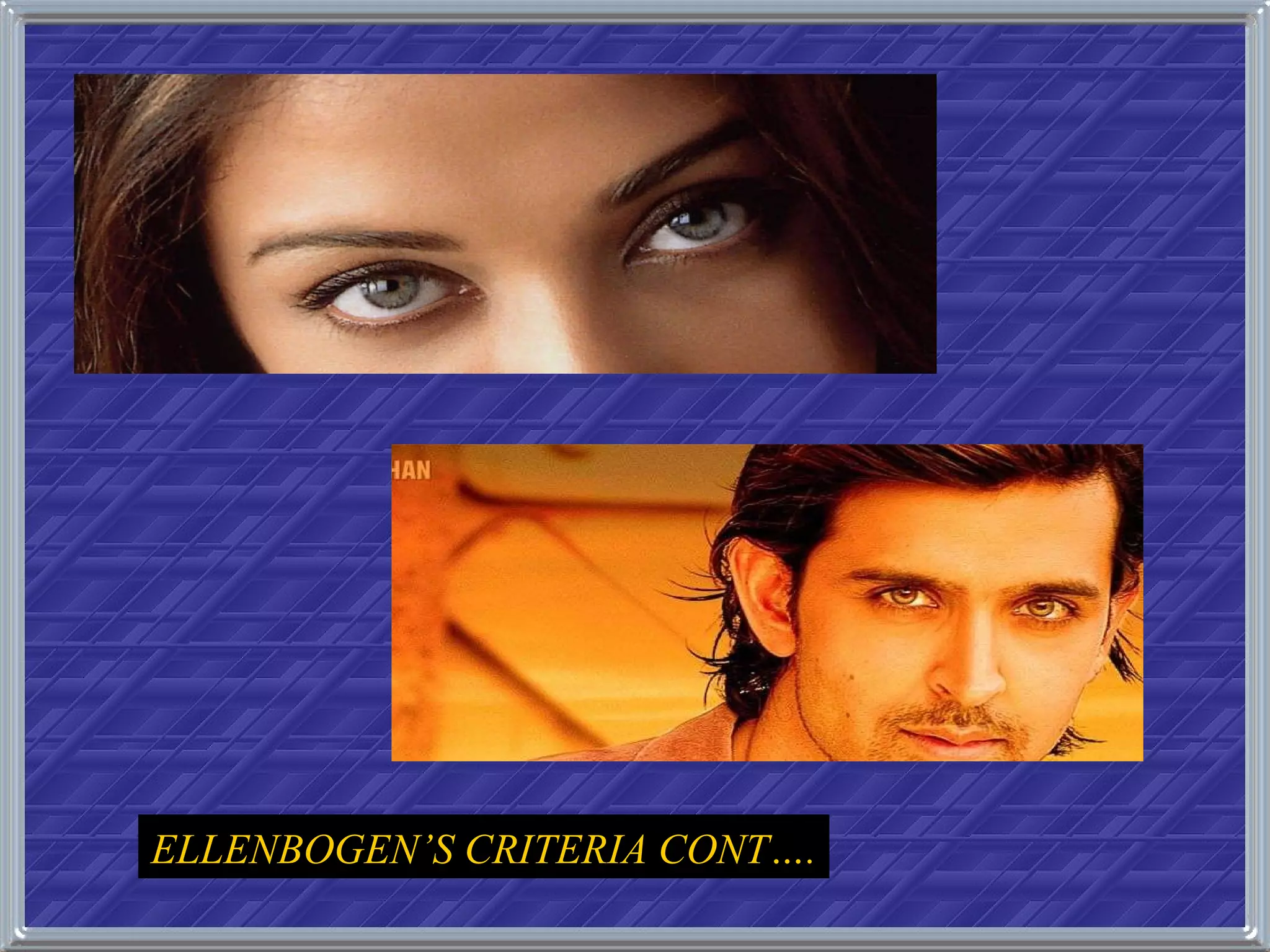 ELLENBOGEN’S CRITERIA CONT…. 