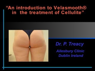 “ An introduction to Velasmooth®  in  the treatment of Cellulite” Dr. P. Treacy  Ailesbury Clinic  Dublin Ireland 
