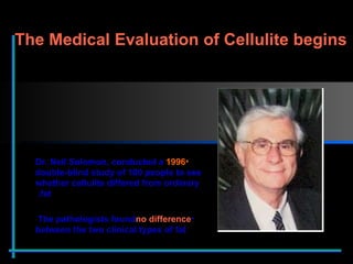1996  Dr. Neil Solomon, conducted a double-blind study of 100 people to see whether cellulite differed from ordinary fat.   The pathologists found  no difference  between the two clinical types of fat The Medical Evaluation of Cellulite begins  