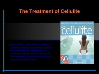 During 1990’s treatments for cellulite    remained largely unsuccessful because    they targeted skin appearance. It    soon was apparent that  dimpling  on    the surface of the skin would require a    deeply acting treatment . The Treatment of Cellulite 