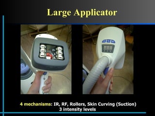 Large Applicator 4 mechanisms : IR, RF, Rollers, Skin Curving (Suction) 3 intensity levels 