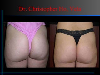 Dr. Christopher Ho, Vela 