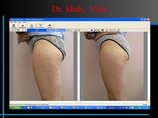 Dr. Shah,  Vela 