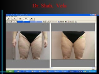Dr. Shah,  Vela 