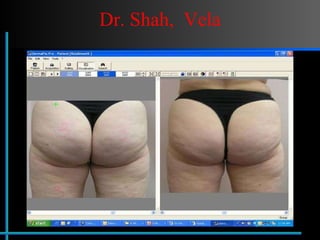 Dr. Shah,  Vela 