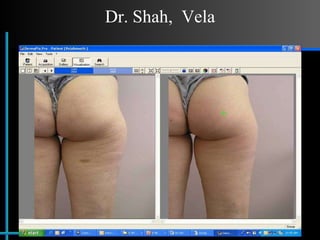 Dr. Shah,  Vela 