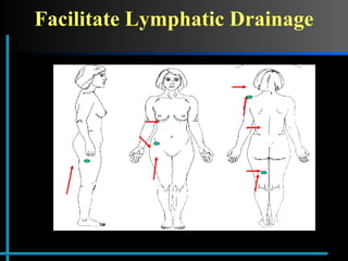 Facilitate Lymphatic Drainage 