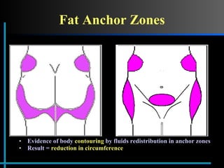 Fat Anchor Zones Evidence of body  contouring  by fluids redistribution in anchor zones Result =  reduction in circumference 