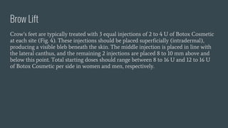 Brow Lift
Crow’s feet are typically treated with 3 equal injections of 2 to 4 U of Botox Cosmetic
at each site (Fig. 4). These injections should be placed superficially (intradermal),
producing a visible bleb beneath the skin. The middle injection is placed in line with
the lateral canthus, and the remaining 2 injections are placed 8 to 10 mm above and
below this point. Total starting doses should range between 8 to 16 U and 12 to 16 U
of Botox Cosmetic per side in women and men, respectively.
 